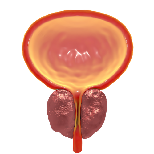 Prostata-3D